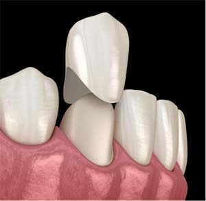 Complete Dental Services
